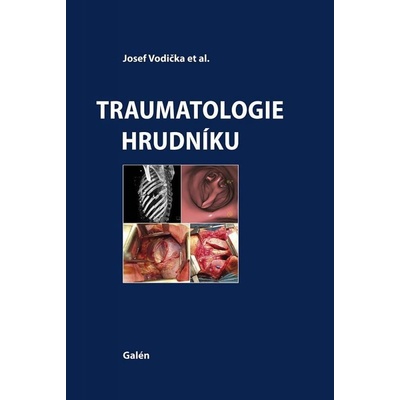 Traumatologie hrudníku