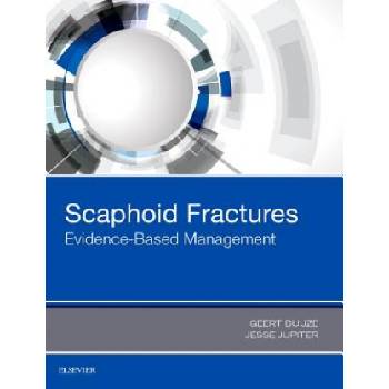 Scaphoid Fractures | Geert Buijze, Jesse B. Jupiter