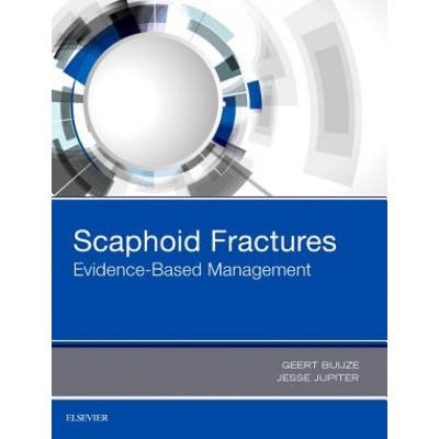 Scaphoid Fractures | Geert Buijze, Jesse B. Jupiter
