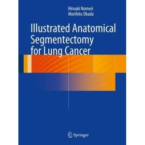 Illustrated Anatomical Segmentectomy for Lung Cancer | Hiroaki Nomori, Morihito Okada (2012)