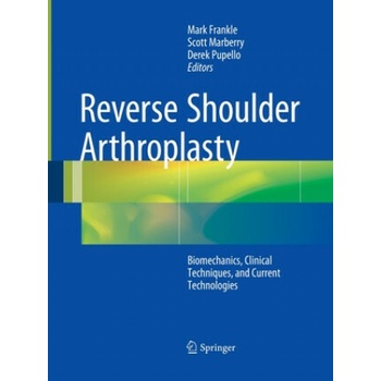 Reverse Shoulder Arthroplasty