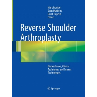 Reverse Shoulder Arthroplasty