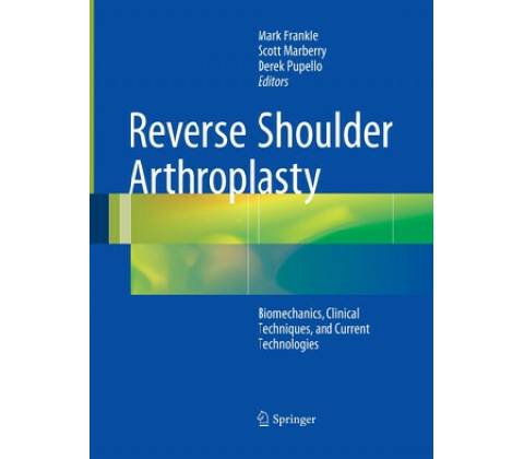 Reverse Shoulder Arthroplasty