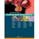 Adenomy hypofýzy