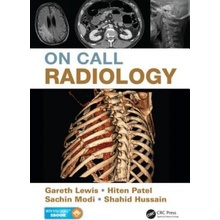 On Call Radiology - Lewis Gareth