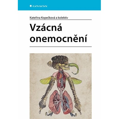 Vzácná onemocnění - Kateřina Kopečková