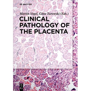 Clinical Pathology of the Placenta | Martin Vogel, Gitta Turowski (ISBN: 9783110449976)