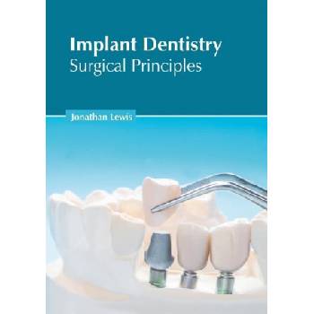Implant Dentistry: Surgical Principles