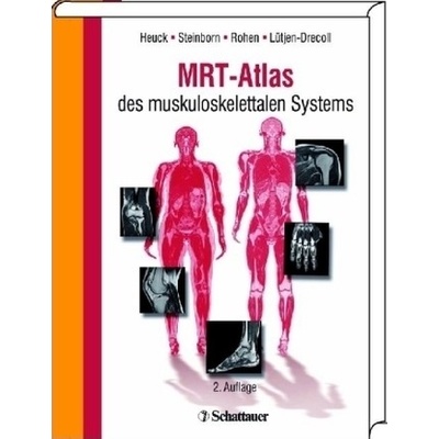 MRT -Atlas des muskuloskelettalen Systems - Heuck, Andreas