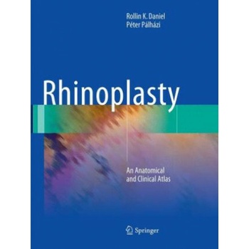 Rhinoplasty