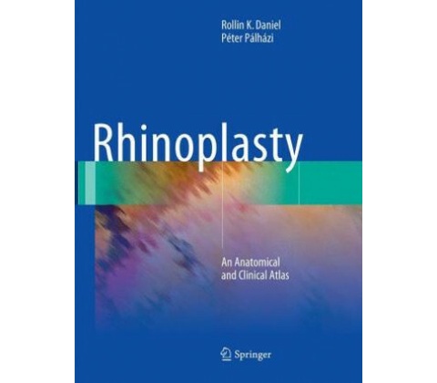 Rhinoplasty