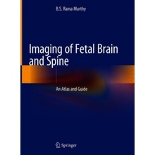 Imaging of Fetal Brain and Spine