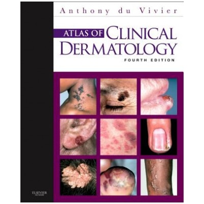 Atlas of Clinical Dermatology