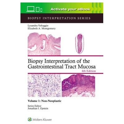 Biopsy Interpretation of the Gastrointestinal Tract Mucosa Volume 1: Non-Neoplastic: Print + eBook with Multimedia Volume 1 (Voltaggio Lysandra)