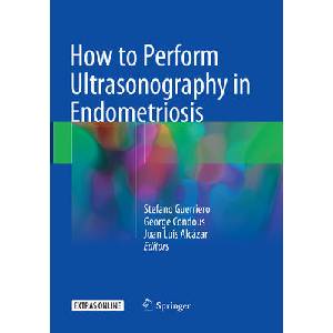 How to Perform Ultrasonography in Endometriosis | Stefano Guerriero, George Condous, Juan Luis Alcázar (ISBN: 9783030100193)