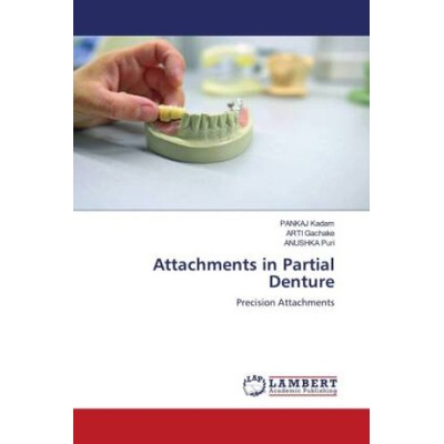 Attachments in Partial Denture | Arti Gachake, Anushka Puri