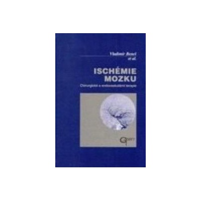 Ischémie mozku - Vladimír Beneš