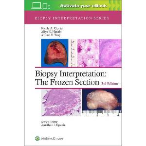 Biopsy Interpretation: The Frozen Section | Nicole A. Cipriani, Aliya N. Husain, Jerome B. Taxy (ISBN: 9781975170073)