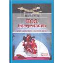 ECG - Interpretation