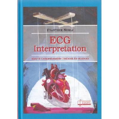 ECG - Interpretation