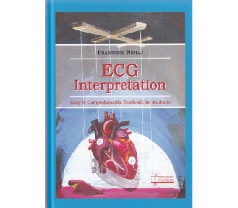 ECG - Interpretation