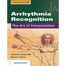 Arrhythmia Recognition