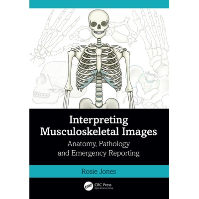 Interpreting Musculoskeletal Images - Rosie Jones