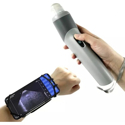 Ultrazvukový scanner W3 bezdrátový s abdominální sondou