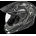 Icon Variant Pro Totem