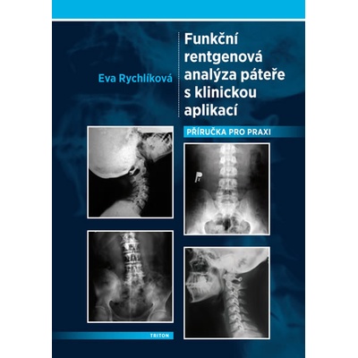Funkční rentgenová analýza páteře s klinickou aplikací - Eva Rychlíková