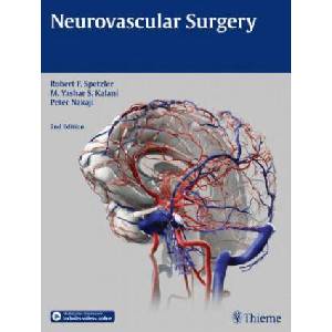 Neurovascular Surgery | Robert F. Spetzler, M. Yashar S. Kalani, Peter Nakaji (ISBN: 9781604067590)