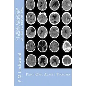 CT Head: DIAGNOSIS A Radiographers Guide To Reporting Part 1 Acute Trauma: Part One Acute Trauma | P M Lockwood (ISBN: 9781467923934)