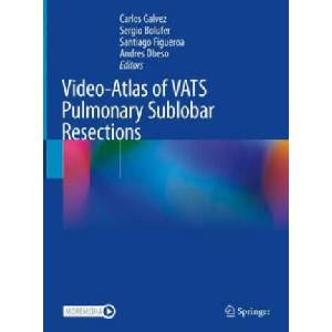 Video-Atlas of VATS Pulmonary Sublobar Resections | Carlos Galvez, Sergio Bolufer, Santiago Figueroa, Andres Obeso (ISBN: 9783031144547)