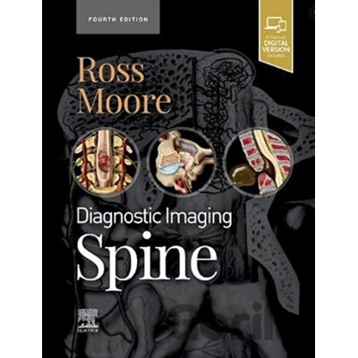Diagnostic Imaging: Spine - Kevin R. Moore, Jeffrey S. Ross