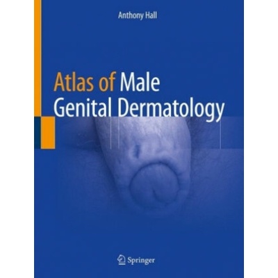 Atlas of Male Genital Dermatology Hall Anthony