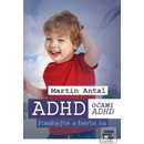 ADHD očami ADHD