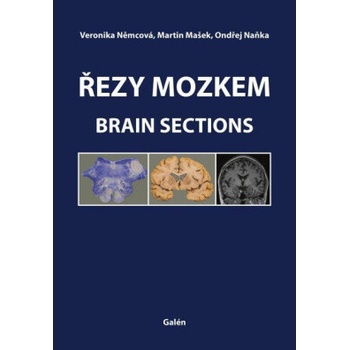 Řezy mozkem