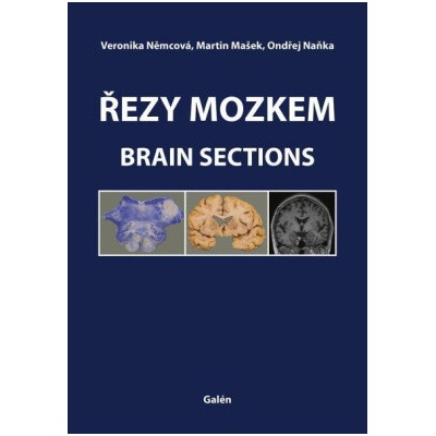 Řezy mozkem