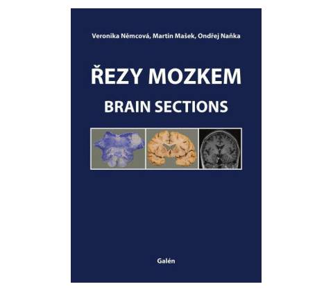Řezy mozkem