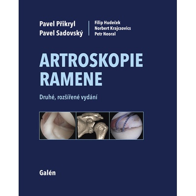Artroskopie ramene - Druhé, rozšířené vydání