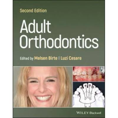 Adult Orthodontics 2nd Edition | B Melsen