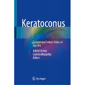 Keratoconus: Current and Future State-Of-The-Art | Ashraf Armia, Cosimo Mazzotta (ISBN: 9783030845056)