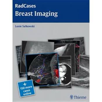 Image 1 of Radcases Breast Imaging