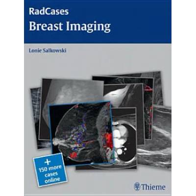 Radcases Breast Imaging