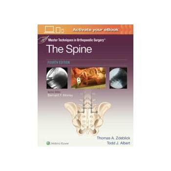 Image 1 of Master Techniques in Orthopaedic Surgery: The Spine | Thomas A. Zdeblick