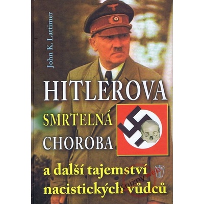 Hitlerova smrtelná choroba a další tajemství nacistických vůdců