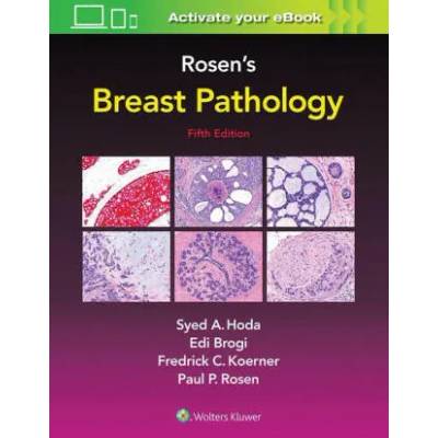 Rosen's Breast Pathology | Frederick C. Koerner, Paul Peter Rosen, Syed A. Hoda