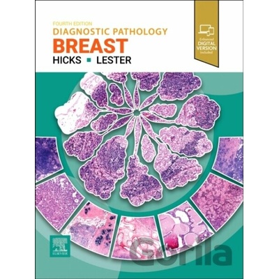 Diagnostic Pathology: Breast - Susan C. Lester, David G. Hicks