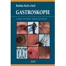 Gastroskopie - Radan Keil