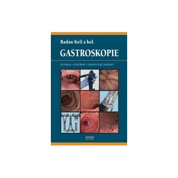 Gastroskopie - Radan Keil